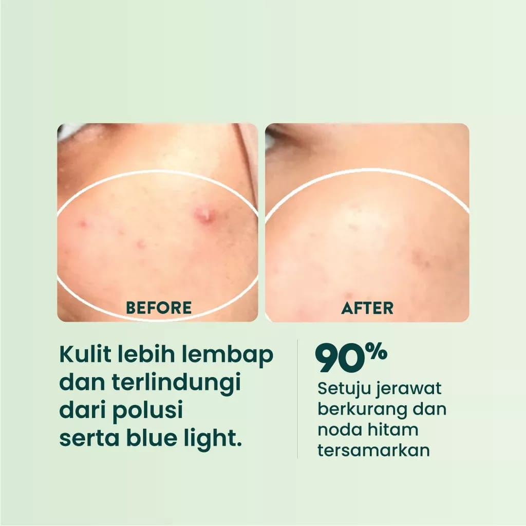 Npure Day &amp; Night Cream Centella Asiatica 15 Gram - Cica Acne Series (Krim Siang &amp; Malam) - Skincare Krim Pagi Sleeping mask Mousturizer CTMP