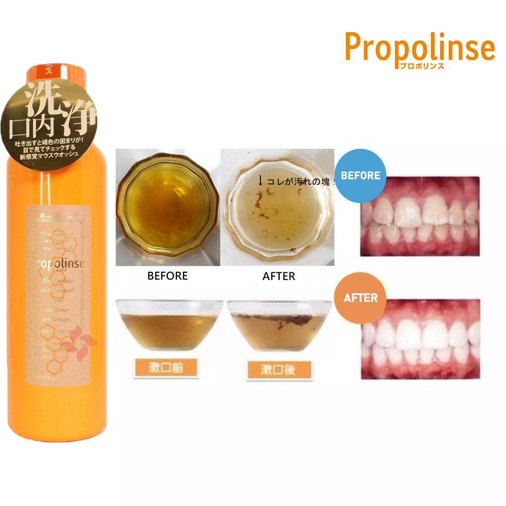 「Official Store」100% ORIGINAL PROPOLINSE - Obat Kumur Original Orange Pemutih gigi Propolis Mouthwash 150/600ml /Pieras Propolinse Mouthwash Jepang/Pembersih Mulut Ukuran