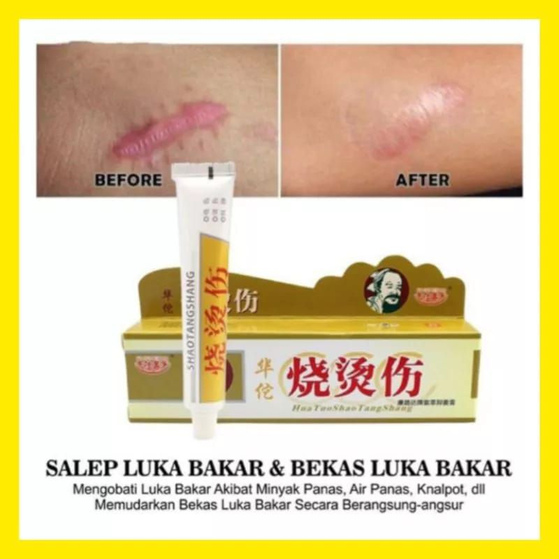 salep obat luka bakar china original cina shao tang shang