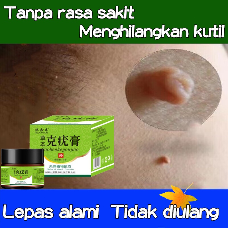 Krim kutil obat penghilang kutil penghilang kutil 20g skin tag remover Menghilangkan kutil, tahi lalat, berbagai skin tag di berbagai bagian tubuh