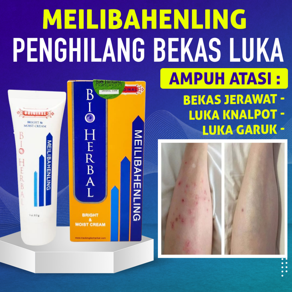 Bio Herbal Meilibahenling Melibahenling asli 100 % Original  / Salep Penghilang Bekas Luka Cacar / bekas kulit luka / bekas cacar / obat cacar air / luka cacar air / penghilang bekas luka pada kulit / Bio Herbal asli 100 % Original