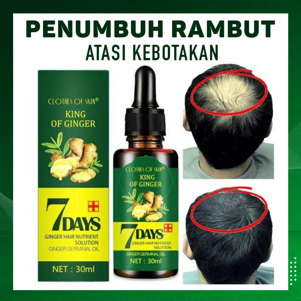 Penumbuh Botak Dan Rontok (HANYA 7 HARI) Pria Anak Bayi Balita Cepat Serum Essence Penghitam Uban Penyubur / 7 Days Ginger Germinal Original