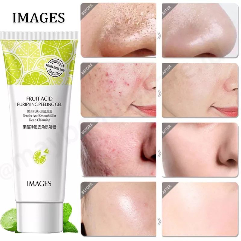 GRATIS ONGKIR COD MEDAN TERMURAH EKSFOLIASI KULIT WAJAH LIME 80G PEELING GEL EXFOLIATING EM044