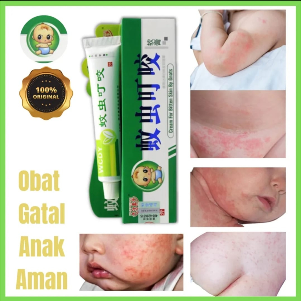Salep Gatal untuk Bayi dan Anak Usia 0-7 Tahun, Membantu Meredakan Ruam, Alergi, Eksim, Biang Kering