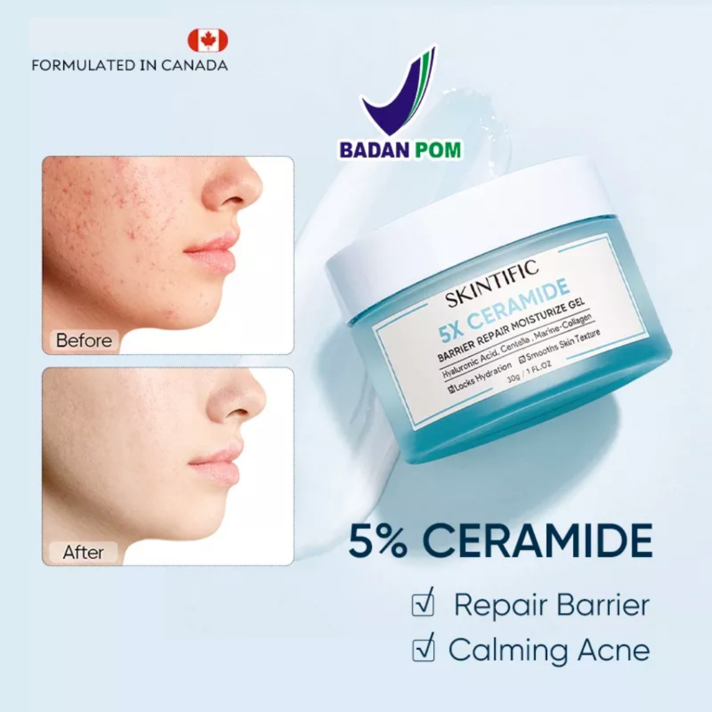 SKINTIFIC 5X Ceramide Barrier Repair Moisturize Gel Moisturizer 30gr | SKINTIFIC Moist Gel 30gr (100% ORIGINAL &amp; BPOM)