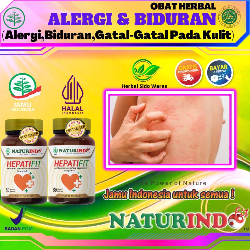 Obat Herbal Gatal Alergi Dingin Obat Biduran Alergi Ampuh Obat Alergi Kulit Gatal Obat Gatal Biduran