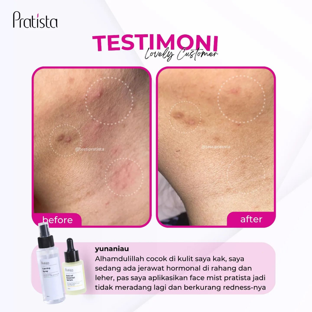 Face Mist BPOM Murah - Calming Spray Pratista - Facemist