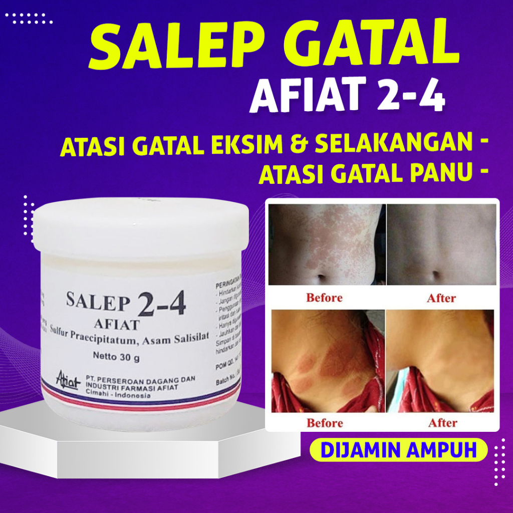 SALEP Afiat 24 Sulfur / Obat Salep Gatal Belerang / Obat Gatal Kulit Selangkangan Jamur Eksim