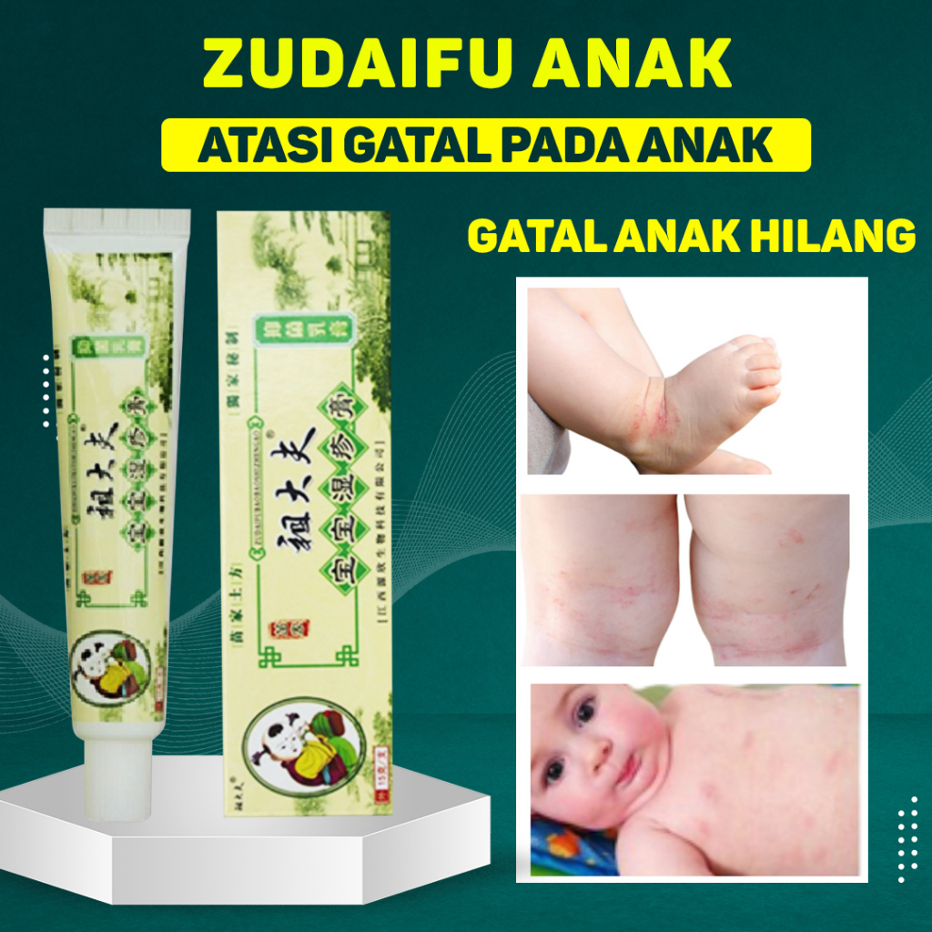 ‼️READY‼️SALEP ZUDAIFU KHUSUS ANAK BAYI - SALEP GATAL ANAK - SALEP EKSIM BAYI SALEP JAMUR SALEP KURAP SCABIES