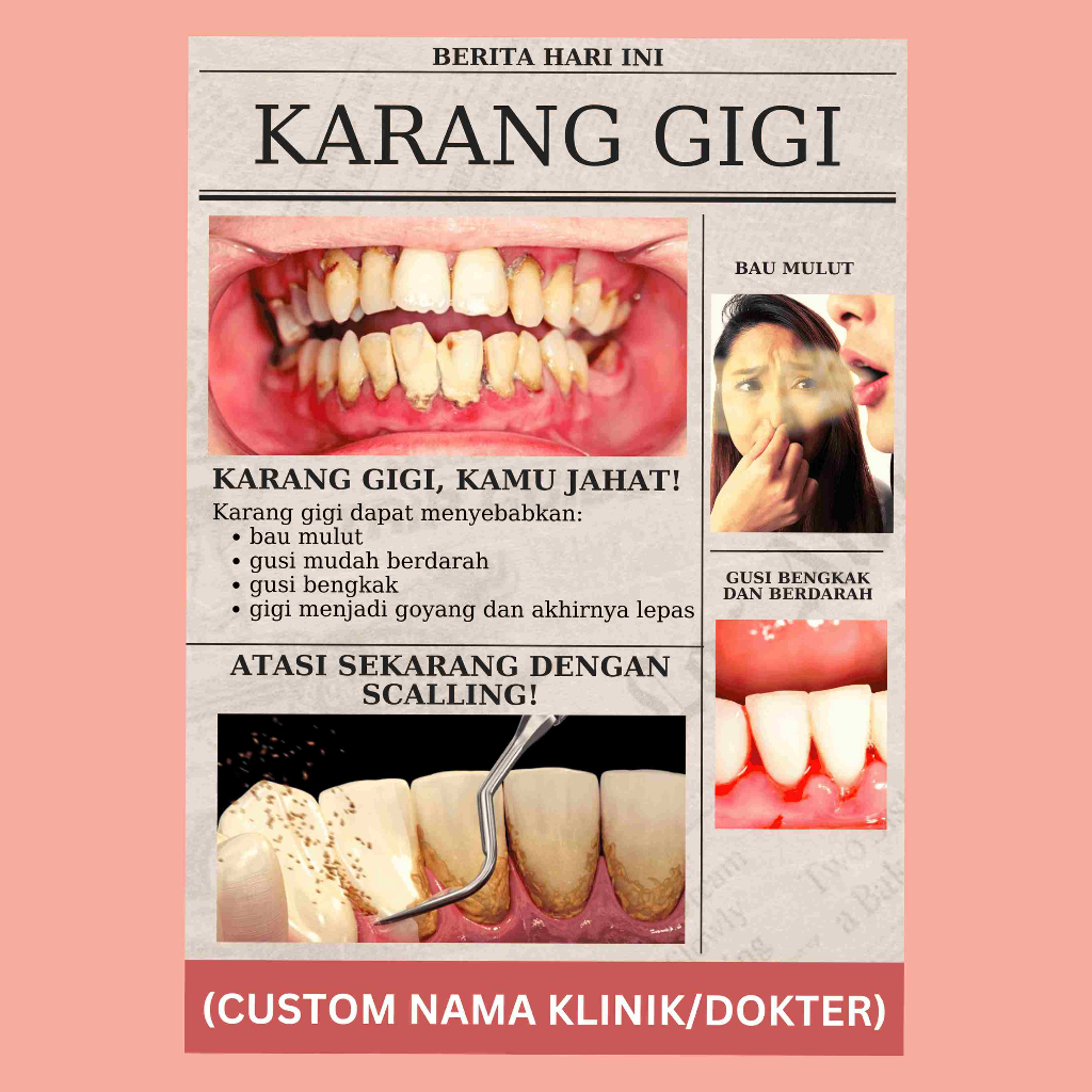 

Poster Karang Gigi