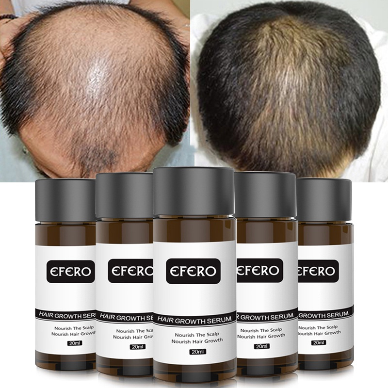 M2SUPPLIER - Efero Penumbuh Rambut 20ML / Brewok / Alis /Jenggot / Kumis / Efero Hair Growth Essenti
