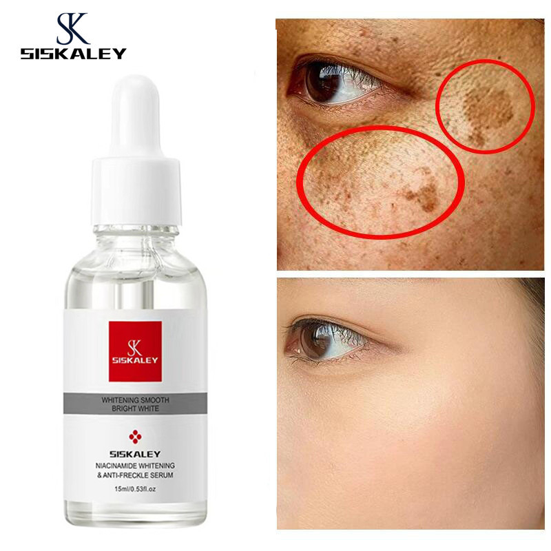 SISKALEY Nicotinamide Whitening Serum Freckles Remove Dark Spots Melasma Brighten Lighten Melanin Improve Dull Anti-Aging 15ml