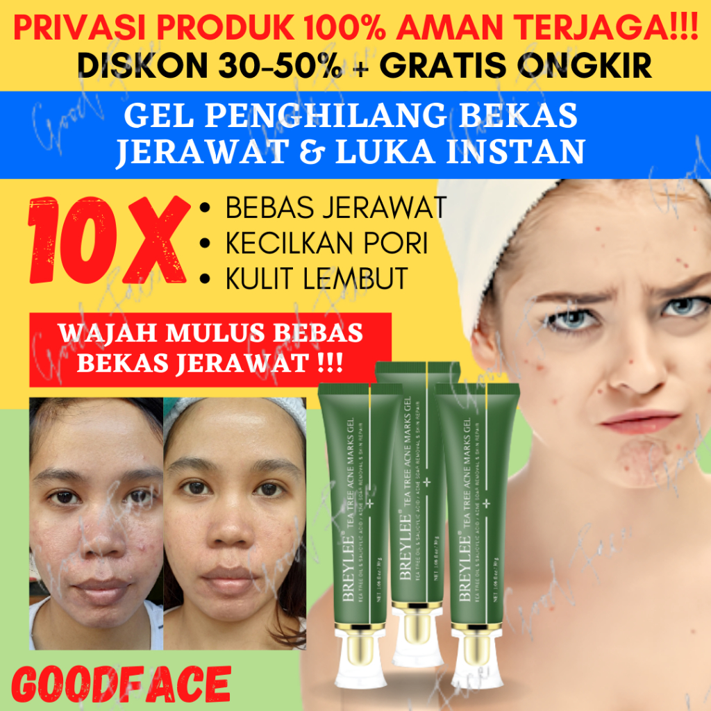 BREYLEE Tea Tree Acne Marks Gel BREYLEE Scar Removal Gel Memudarkan Bekas Jerawat &amp; Memperbaiki Kulit Wajah 30gr