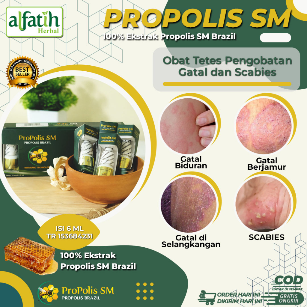 Obat Gatal Selangkangan Obat Gatal Kulit Obat Gatal Eksim Jamur Obat Gatal Kemaluan Scabies dengan P