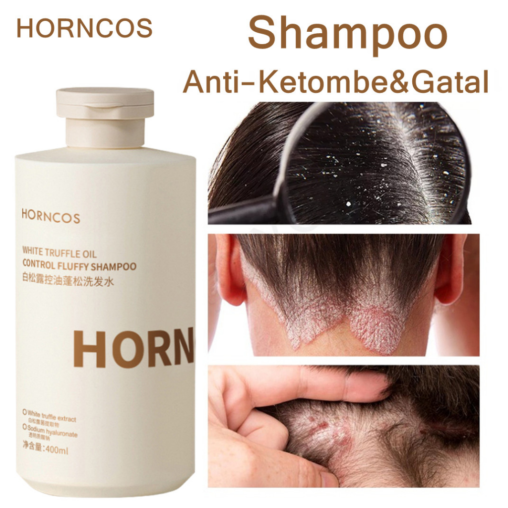 Shampo Anti Ketombe &amp; Anti Gatal dan Mencegah Rambut Rontok Sampo Kontrol Minyak Garam Laut Shampoo Anti Tungau 400ml Original