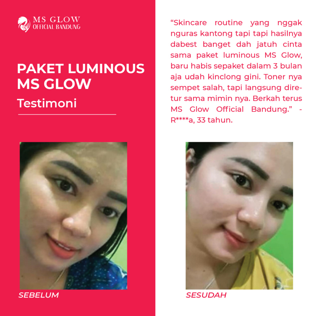 Ms Glow Original Paket Luminous Termurah Berkualitas - By Msglowofficialbandung