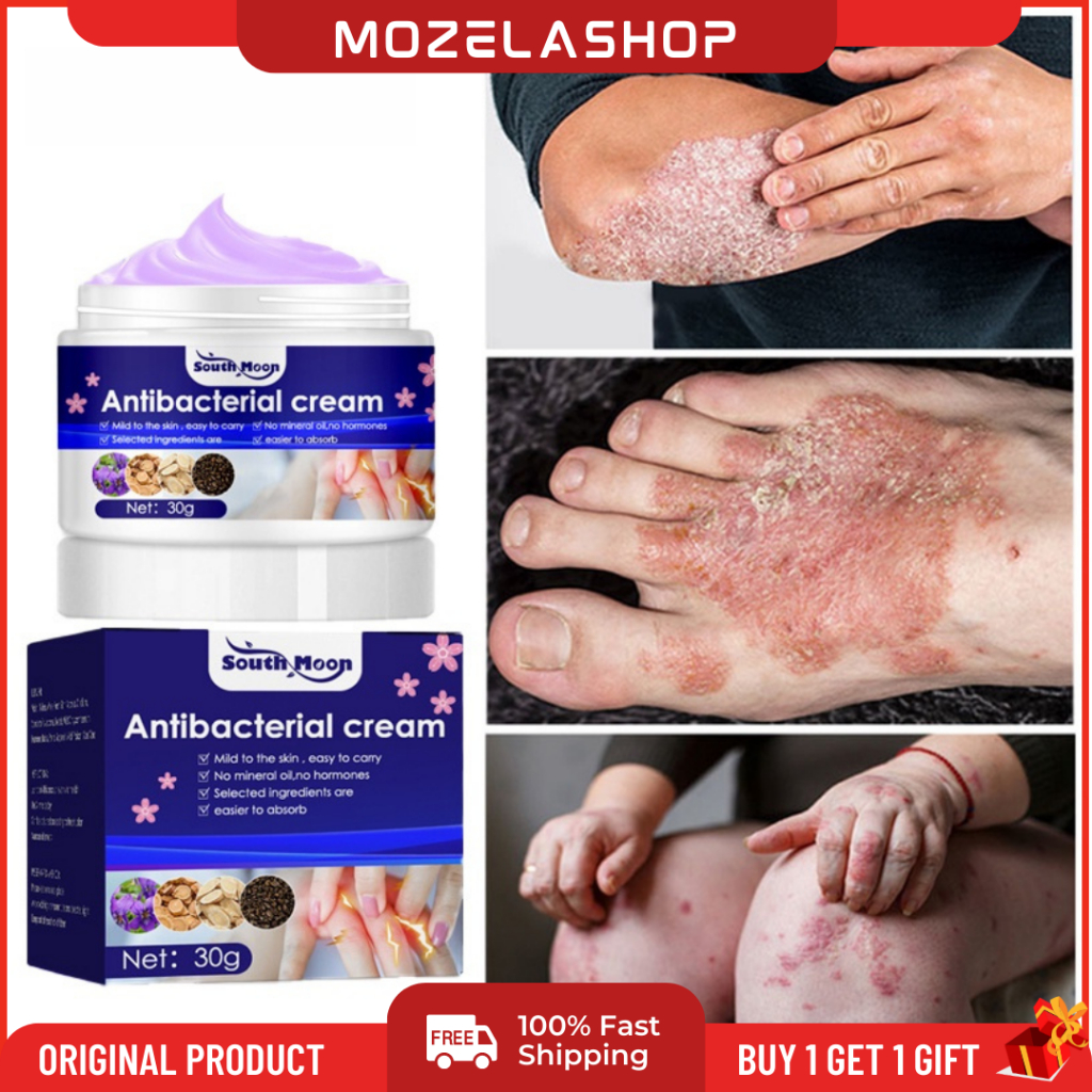 Salep gatal selangkangan Salep gatal pada miss v Anti jamur Salep Salep gatal Menghilangkan Eksim Ku