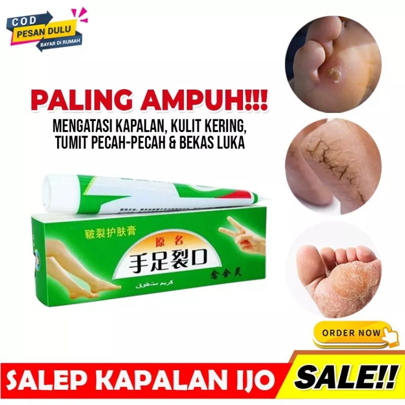 SALEP KAPALAN IJO - SALAP HIJAU MENGATASI KULIT PECAH PECAH