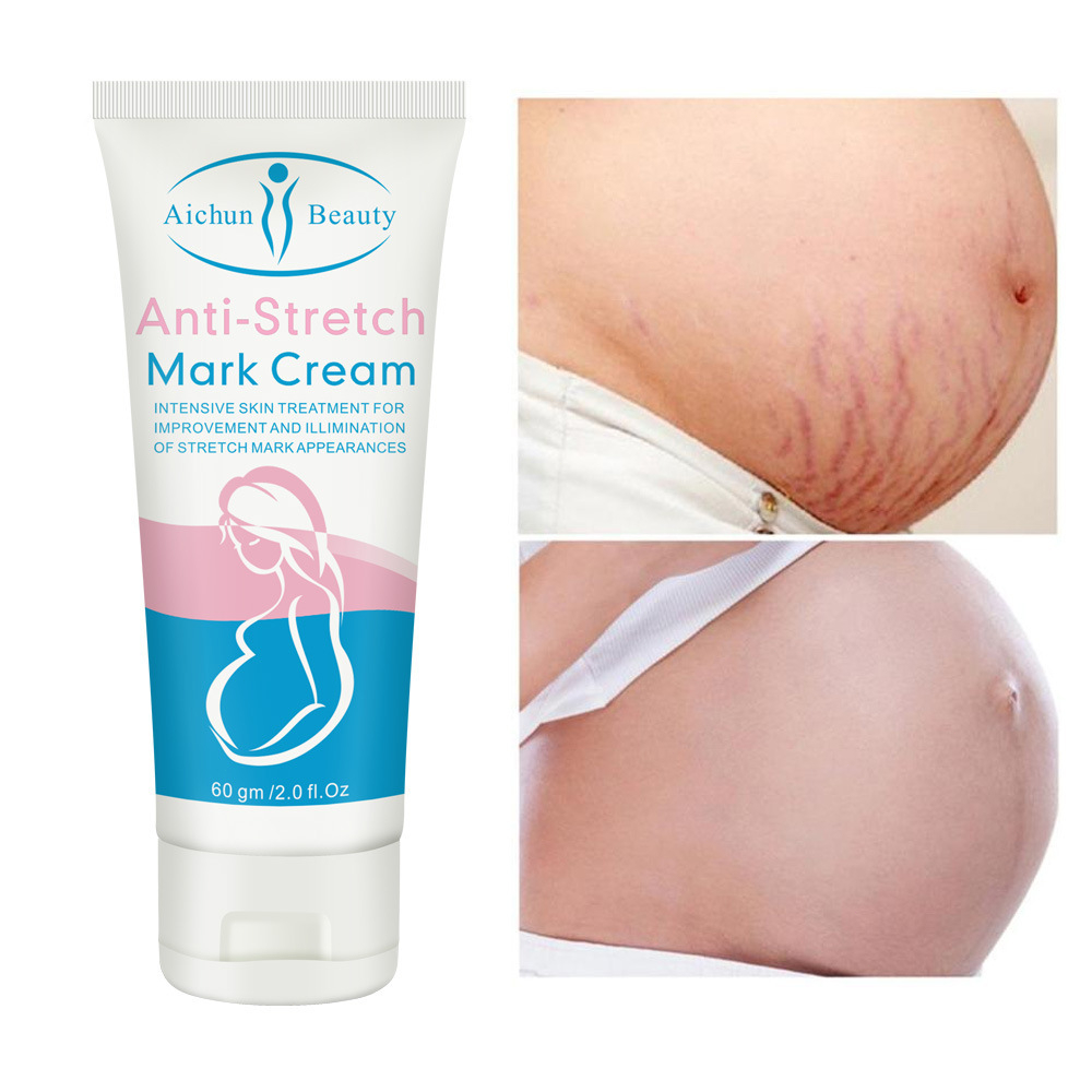 Stretch Mark Cream Anti- Stretch Mark Cream Krim Penghilang Strechmark Pasca Melahirkan Penghilang Bekas Luka 60g [100% Original]