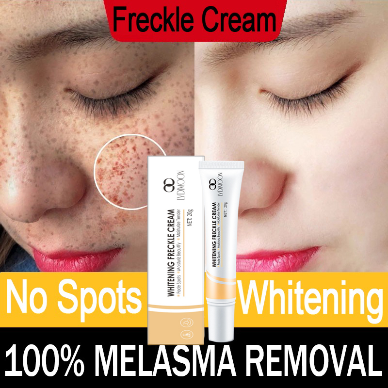 LYDIMOON Cream penghilang flek hitam Krim penghilang flek hitam Krim pemutih wajah 20g Cepat/lembut dan tidak kambuh/menyegarkan dan tidak berminyak/cocok untuk semua bintik