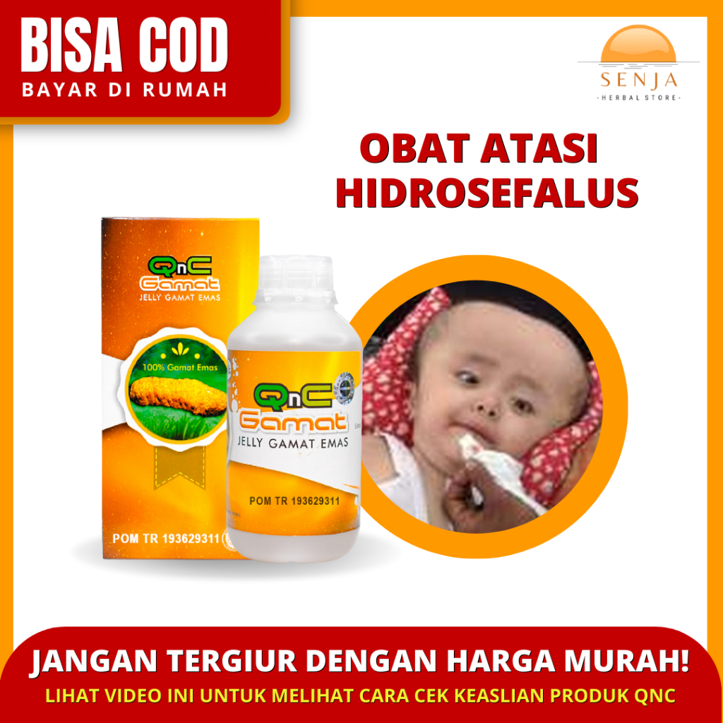 Obat Hidrosefalus, Penghilang Cairan Di Otak, Hidrosefalus Anak, Sakit Kepala Anak - QNC JELLY GAMAT