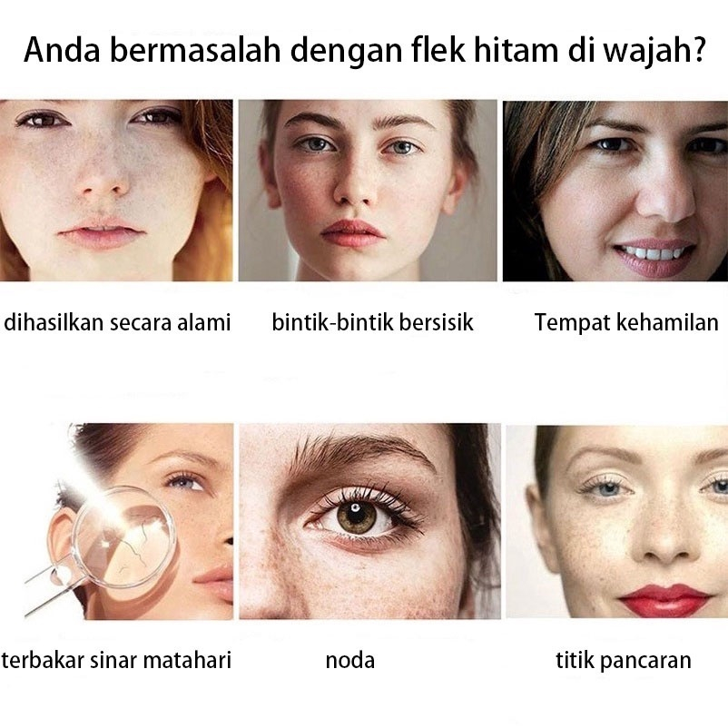 Youbuy Whitening  blemish ori Freckle Cream Peningkatan Bahan Remove Dark Spot &amp; cream pemutih wajah 3% Niacinamide VC 20% + Kolagen Peptida Fade Pigmentation Anti-Penuaan Melasma Brighten Creams 5X Ceramide Skin Barrier Repair  Moisturizer