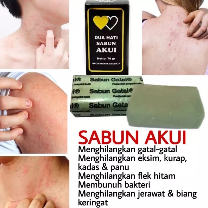 ‼️READY‼️SABUN SULFUR BELERANG - SABUN AKUI - SABUN DUA HATI BPOM - SABUN BELERANG - SABUN GATAL - SABUN EKSIM - SABUN HERBAL BADAN