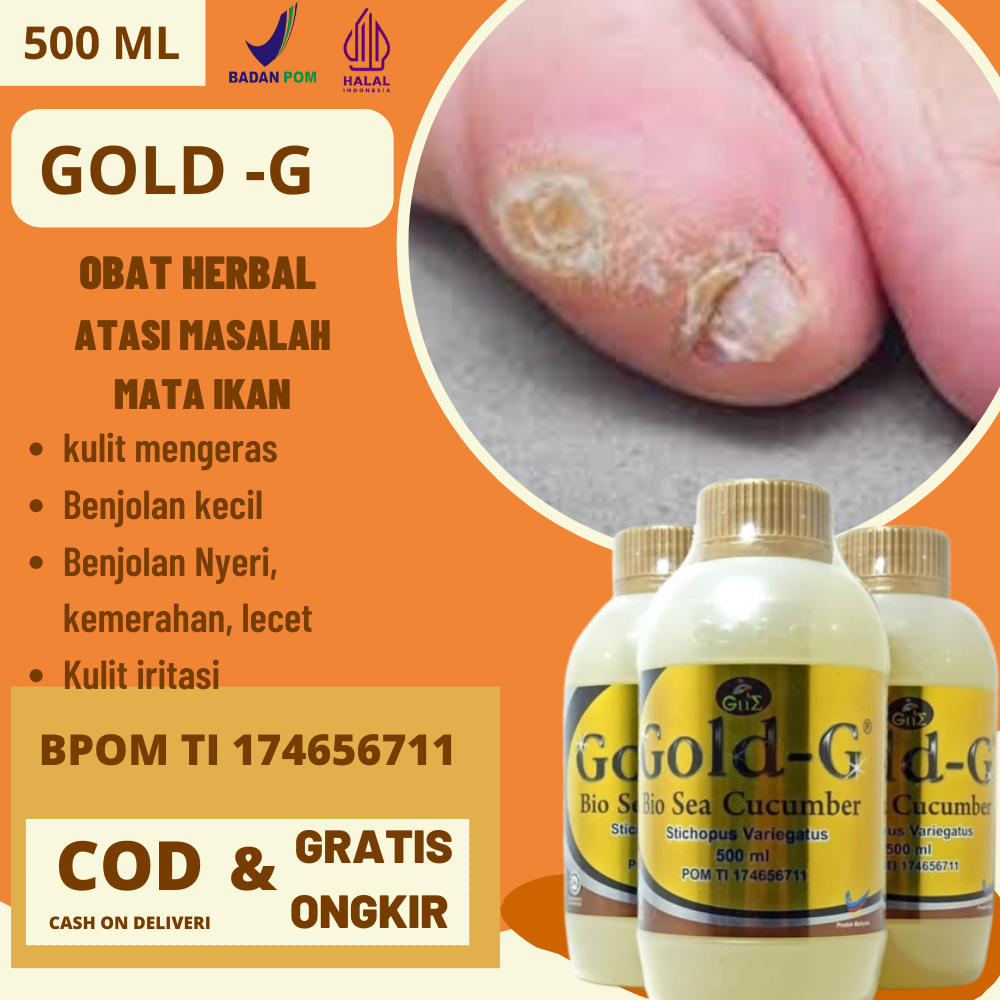 Paling Manjur Obat Herbal Alami Terbaik Atasi Penyakit Mata Ikan Pada Anak Yang Paling Aman