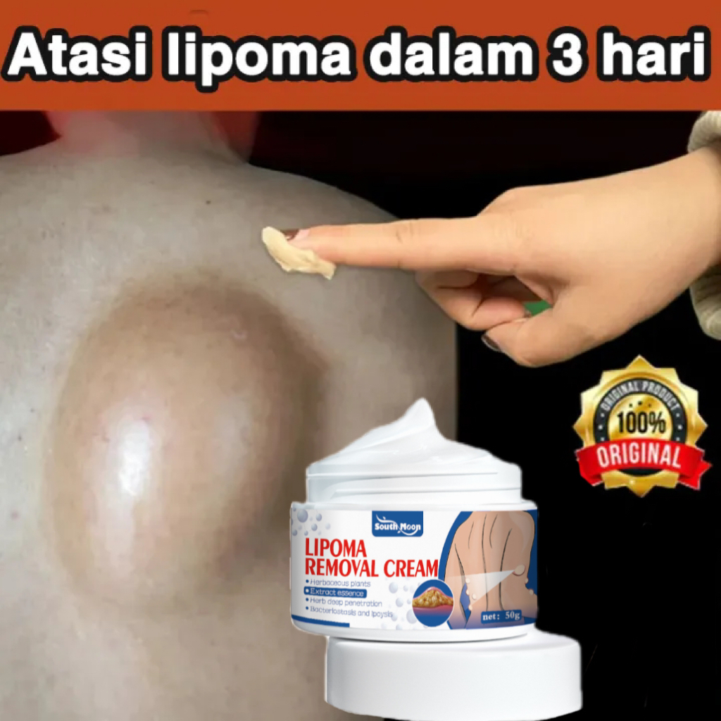 South moon Obat Benjolan Lipoma Obat herbal Cina Krim lipoma 50g Perawatan punggung/leher/paha Kanke