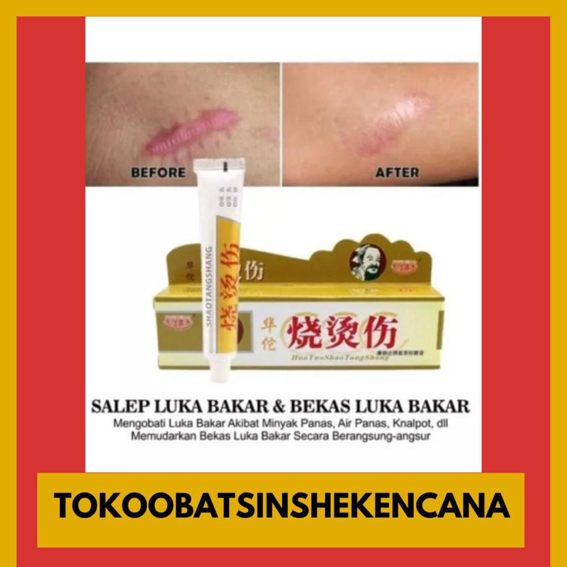 SALEP HUATUO SHAO TANG SHANG ORIGINAL - salep luka bakar, keloid