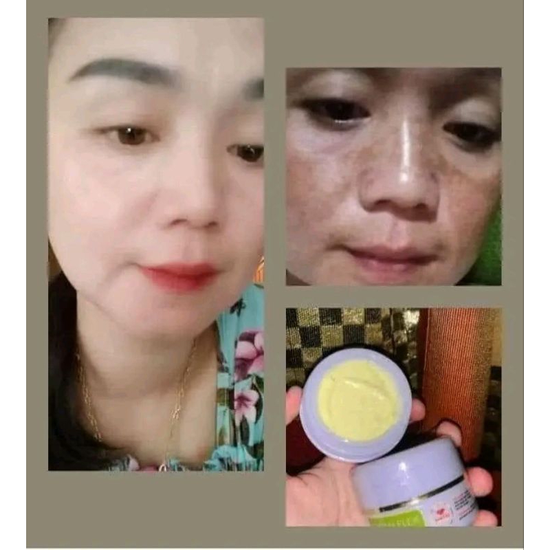 krim flek hitam maxie skincare, maxie skincare member resmi maxie