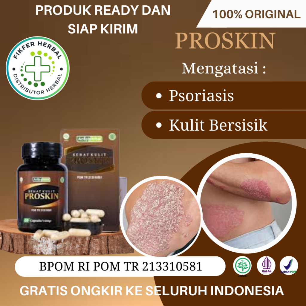Obat Psoriasis, Obat Kulit Bersisik Tebal, Obat Psoriasis di Kepala, Obat Kulit Kering, Obat Kulit M
