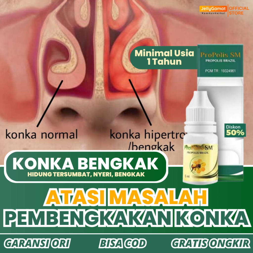 Obat Konka Bengkak Hipertrofi Konka Pembengkakan Hidung Tersumbat Nyeri Dahi Hidung Bengkak Nyeri Sa