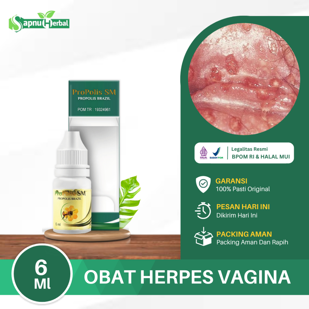 Obat Herpes Vagina, Obat Herpes Di Miss V, Penghilang Herpes Di Kelamin Wanita, Obat Infeksi Jamur K