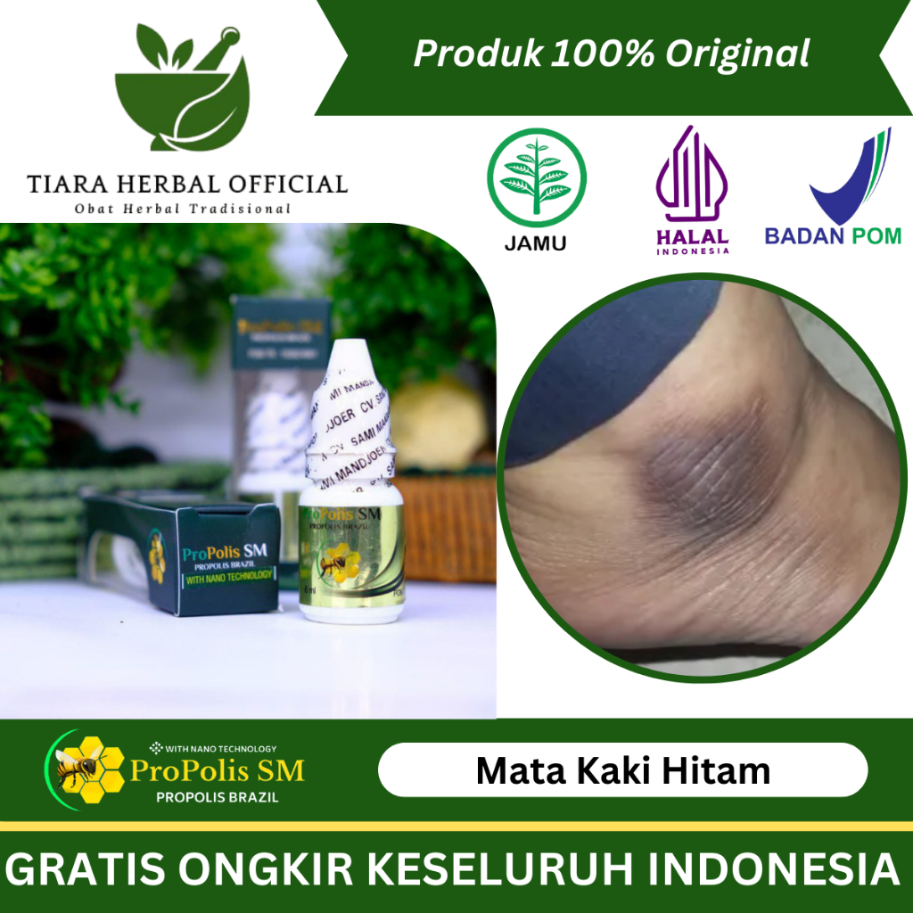 Obat Pemutih Mata Kaki Hitam Dan Kasar, Kapalan, Pecah-Pecah Dan Kering - ProPolis SM