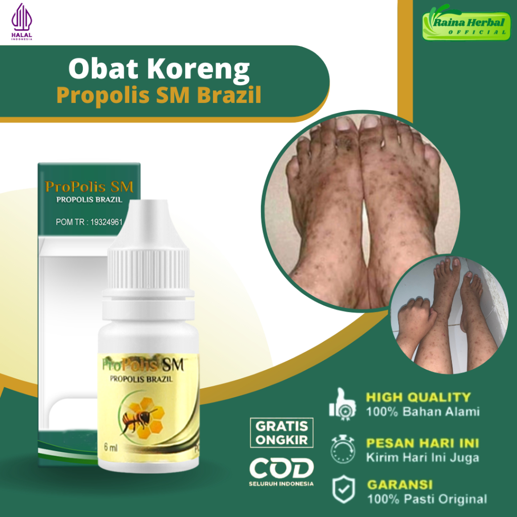 Raina Herbal - Obat Oles Koreng di Kaki Dan Tangan, Obat Koreng Menahun, Obat Korengan, Obat Koreng 