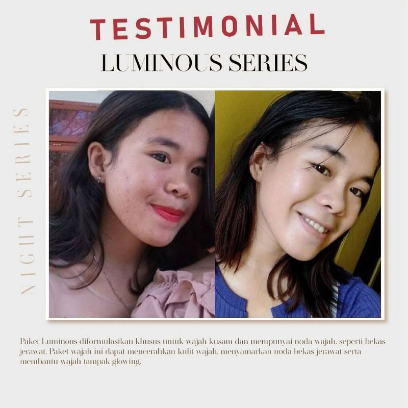 (PAKET+DAY CREAM) READY COD MS GLOW PAKET WAJAH LENGKAP WHITENING ACNE ULTIMATE LUMINOUS WHITECELL DNA