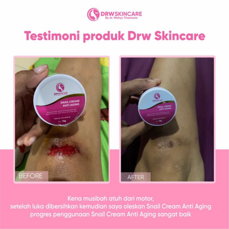 SNAIL CREAM ANTI AGING / CREAM SNAIL / SNAIL CREAM / SNAIL HONEY DRW SKINCARE 100 % ORIGINAL/SNAIL/D