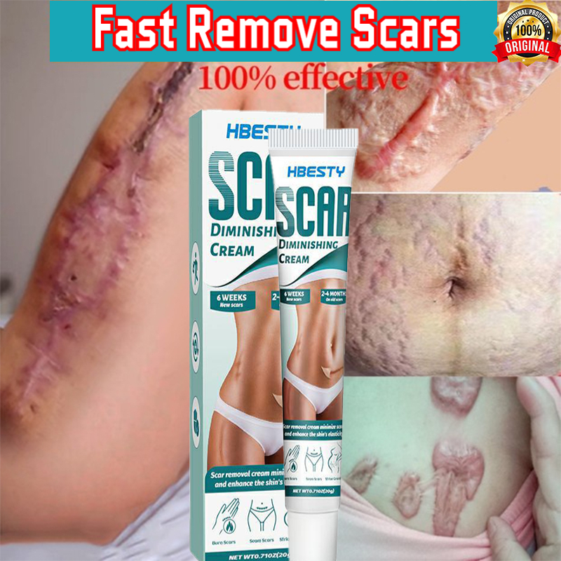 Krim penghilang bekas luka Obat penghilang bekas luka 20g Bekas luka pasca operasi/Stretch mark/Beka