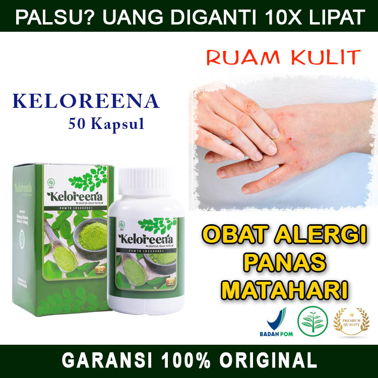 Obat Alergi Panas Matahari, Alergi Keringat, Biduran, Bentol, Ruam Kulit Gatal Kemerahan, Keloreena 