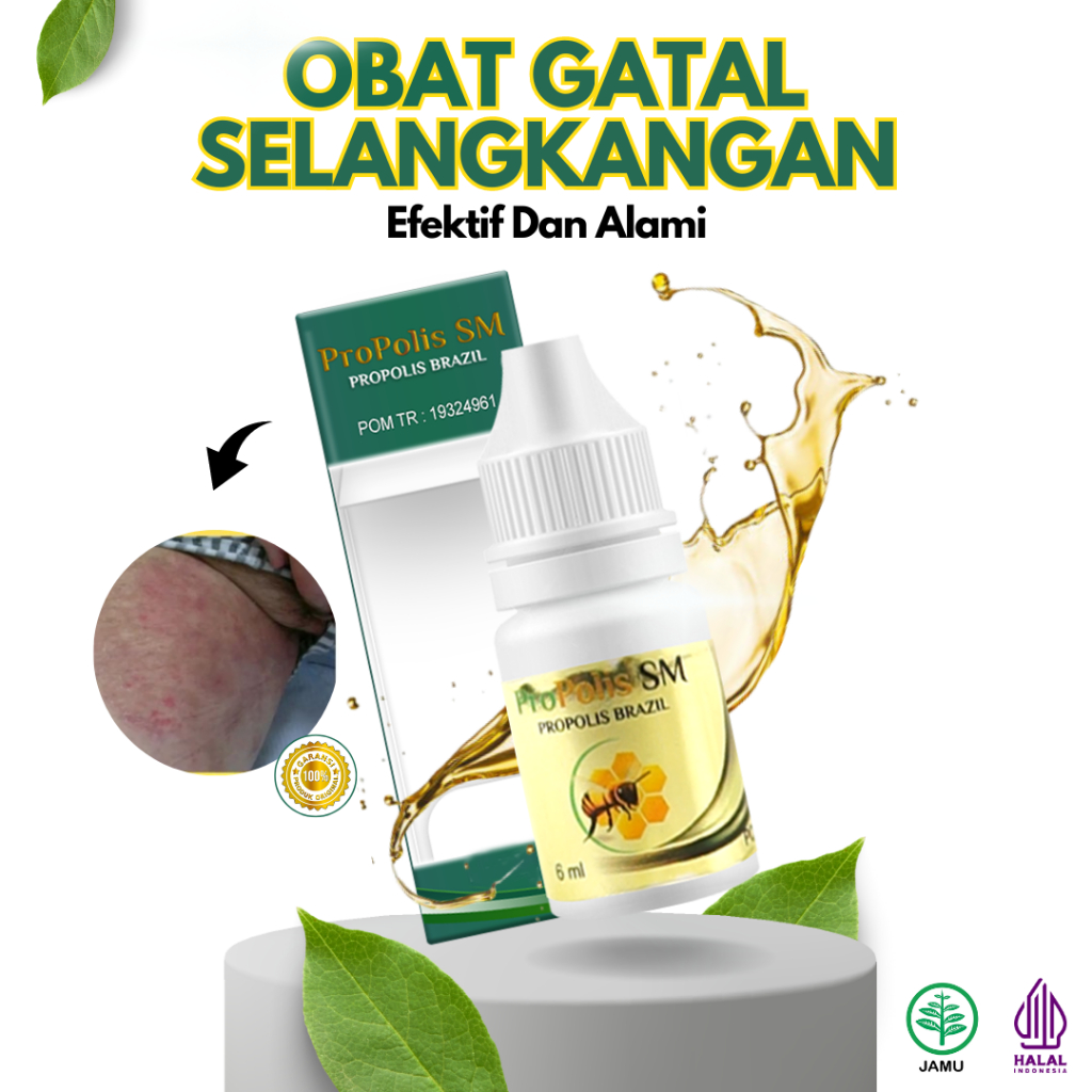 Obat Gatal Selangkangan Karena Jamur Propolis SM Original