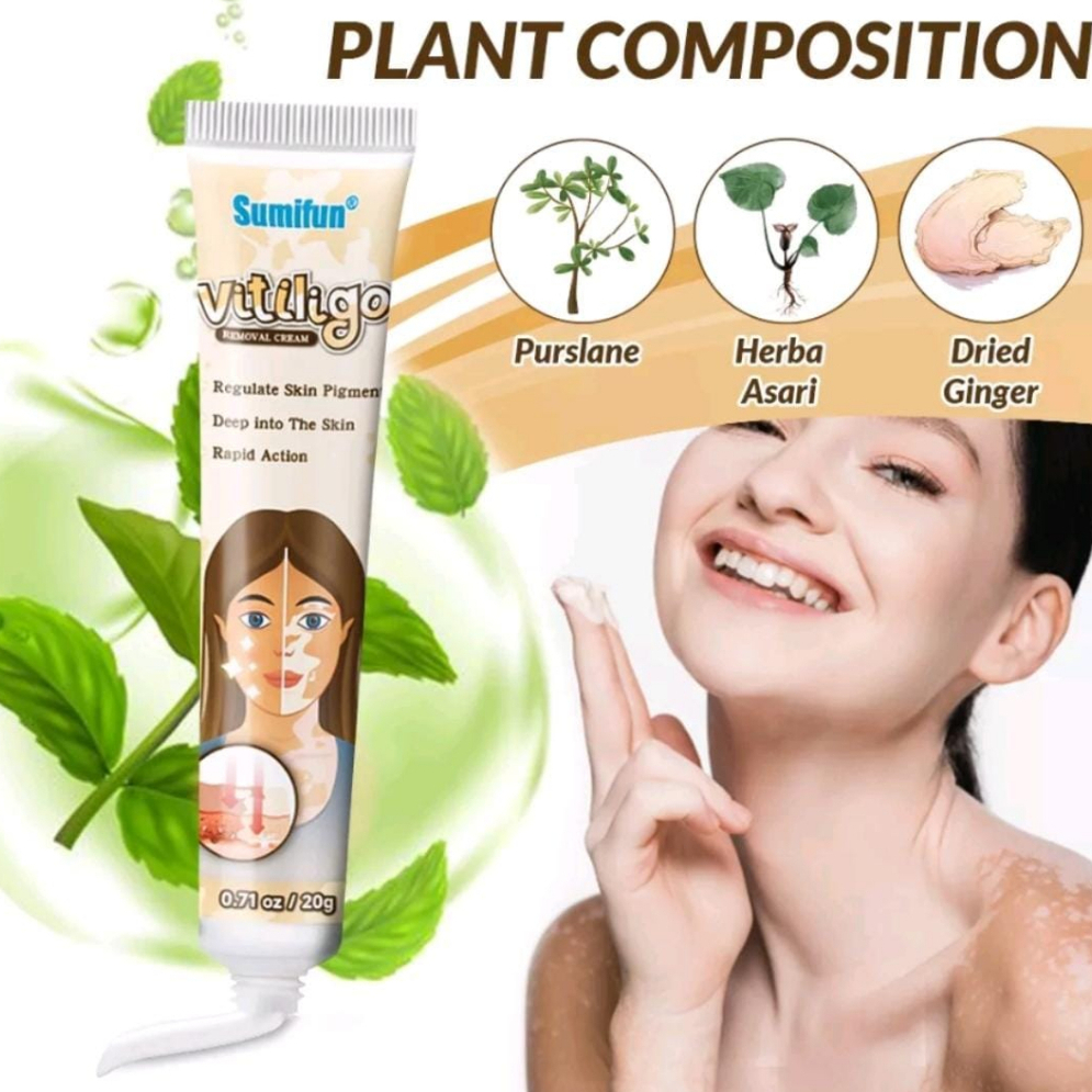 Vitiligo salep vitiligo obat vitiligo Vitiligo treatment cream vitiligo cream