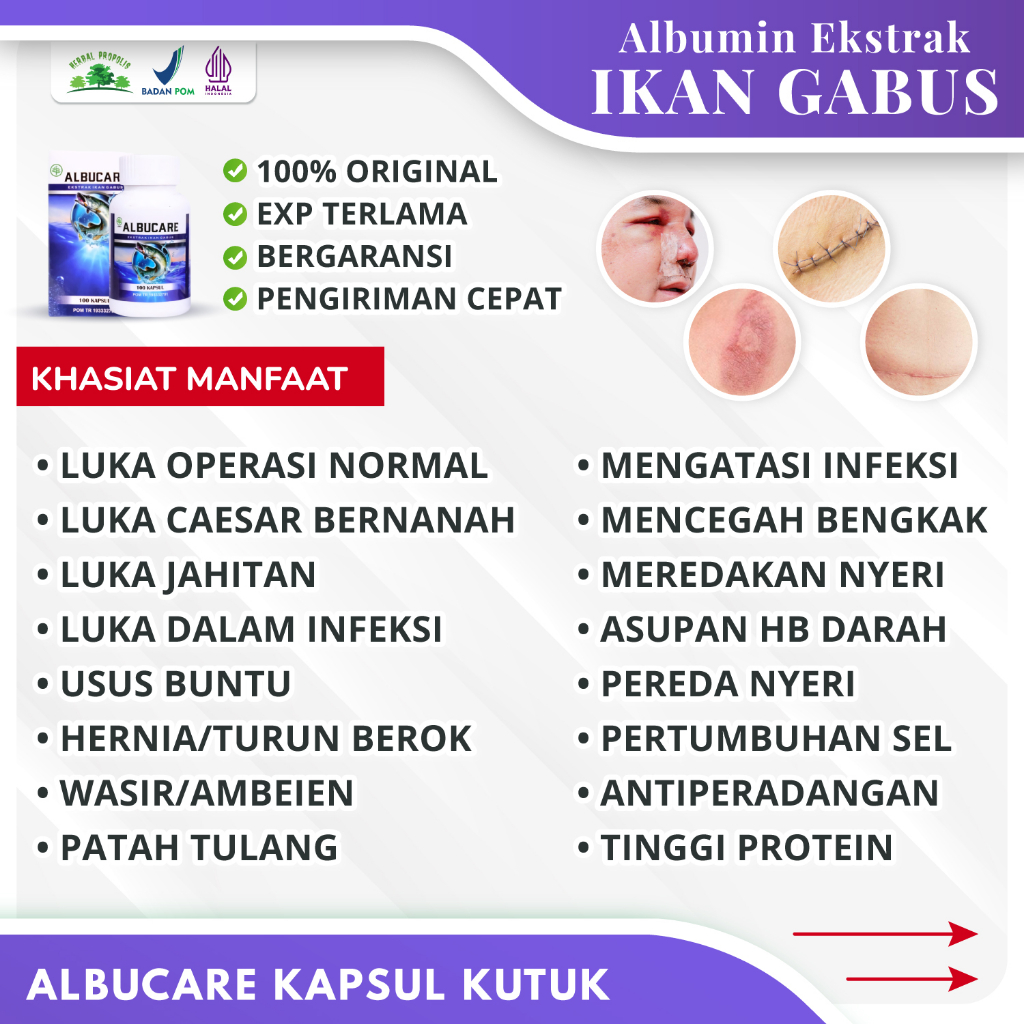 KAPSUL KUTUK ALBUMIN ORIGINAL - Ekstrak Ikan Gabus Mempercepat Penyembuhan Luka - Obat Pasca Operasi