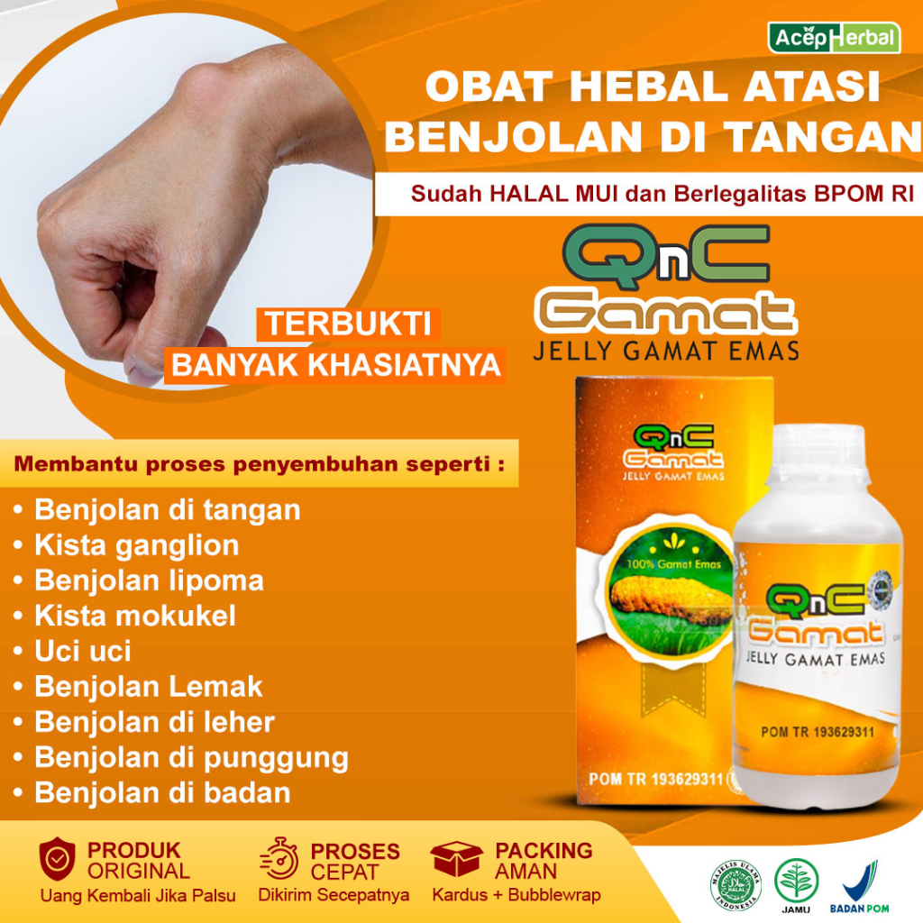 Obat Kista Ganglion Obat Benjolan di Tangan Obat Penghilang Benjolan Obat Benjolan Lipoma Dengan Qnc
