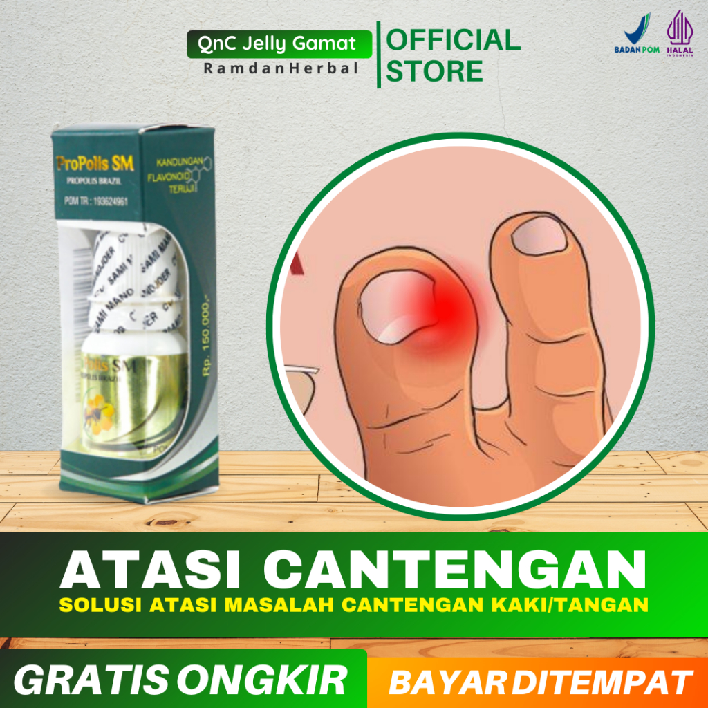 OBAT CANTENGAN BERNANAH JEMPOL KAKI CANTENGAN KUKU JEMPOL KAKI INFEKSI LUKA CANTENGAN PROPOLIS SM