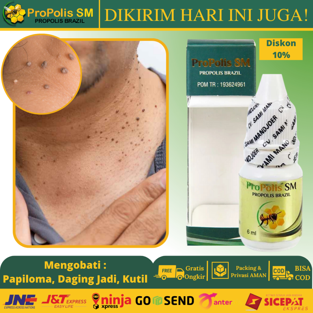 {Terlaris} Obat Repair And Skin Tag Remover Menghilangkan Kutil Papiloma - Obat Penghilang Papiloma 