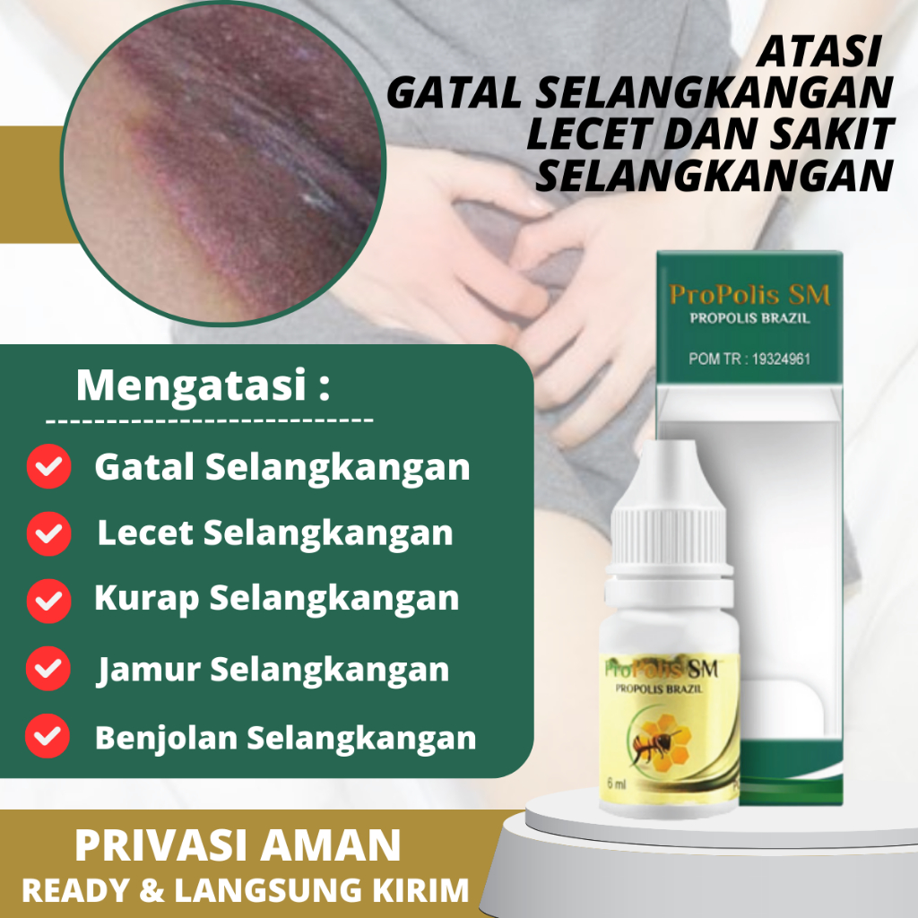 Obat Selangkangan Hitam Babak Gatal Berair Gatal Bernanah Gatal Psoriasis Eksim Jamur Kurap Alergi K