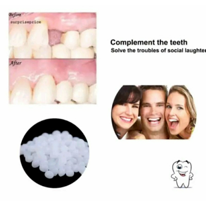 lem gigi palsu penambal gigi