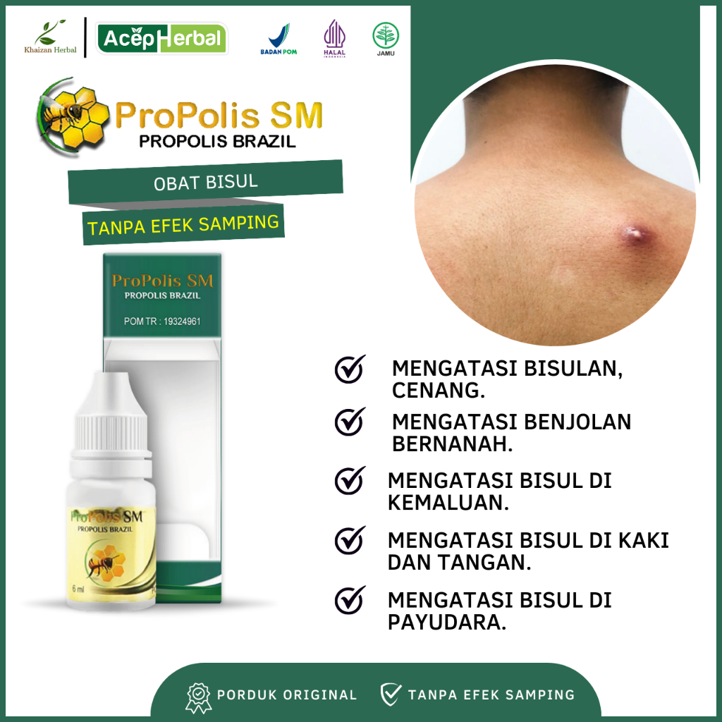 Obat Bisul - Obat Bisulan, Obat Benjolan Bernanah, Obat Bisul Herbal, Obat Bisul di Kemaluan, Obat B