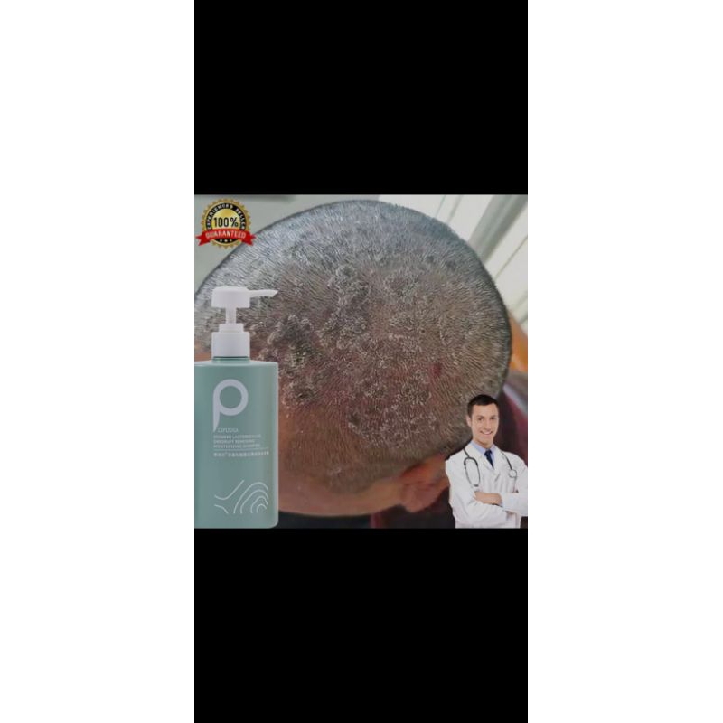 Shampo Anti Ketombe Lifusha